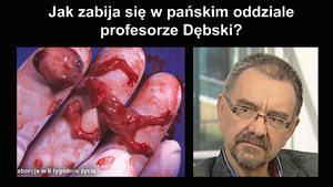 Sprawa prof. Chazana: przypominajmy Przysięgę Hipokratesa